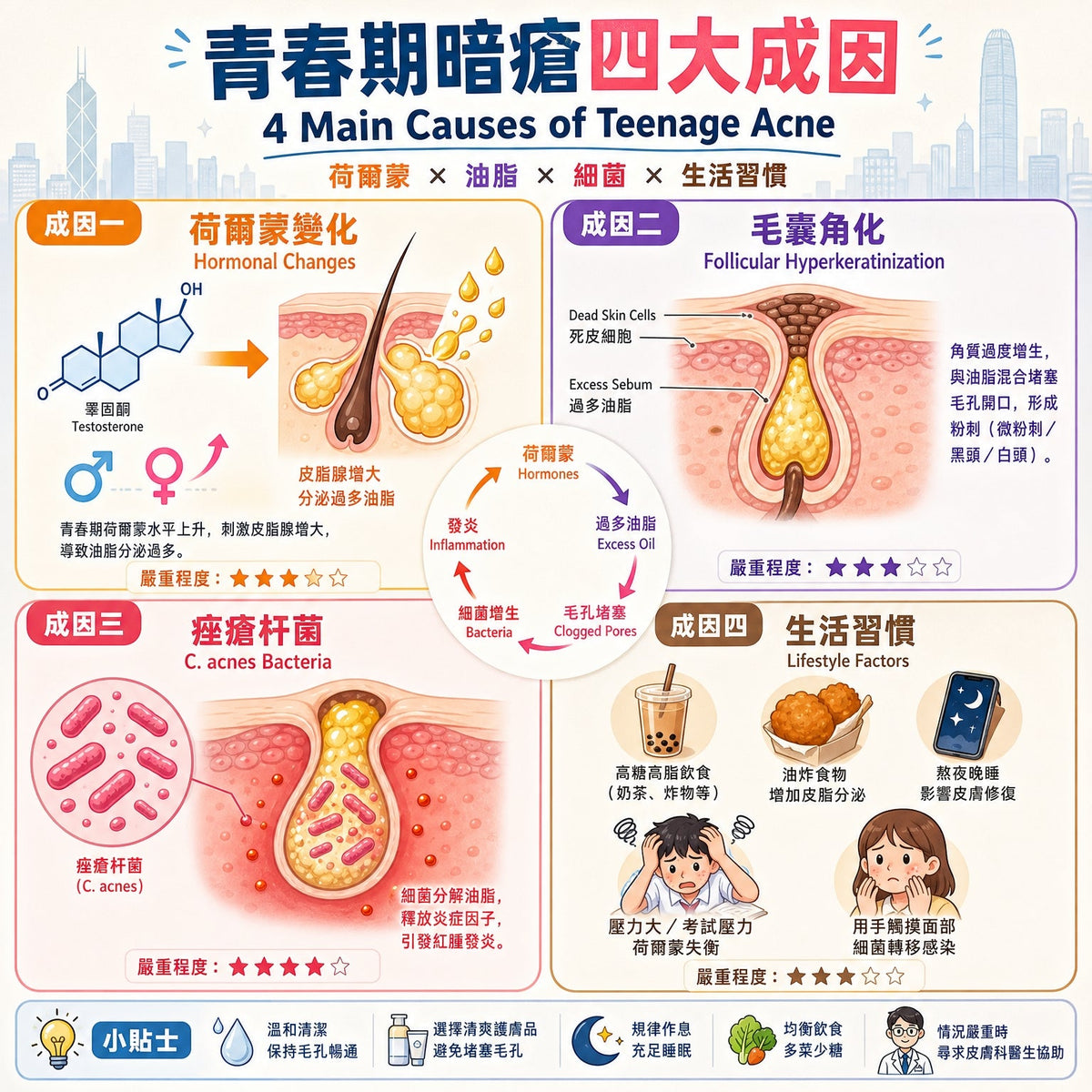 青春期暗瘡原因全解析：荷爾蒙、油脂、細菌三大元凶逐個睇