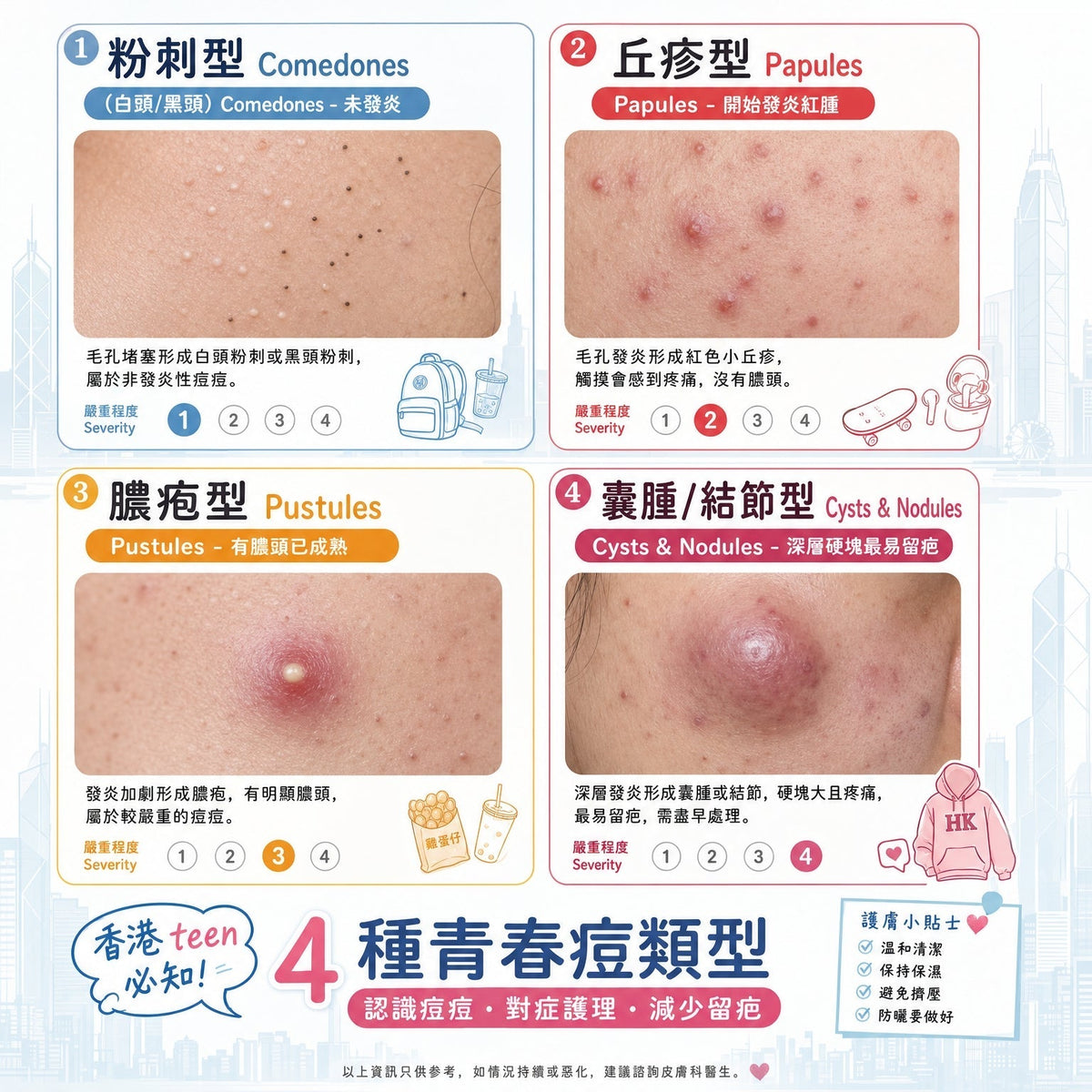 年青人暗瘡處理全攻略：認清類型＋日常護理＋專業療程完整指南